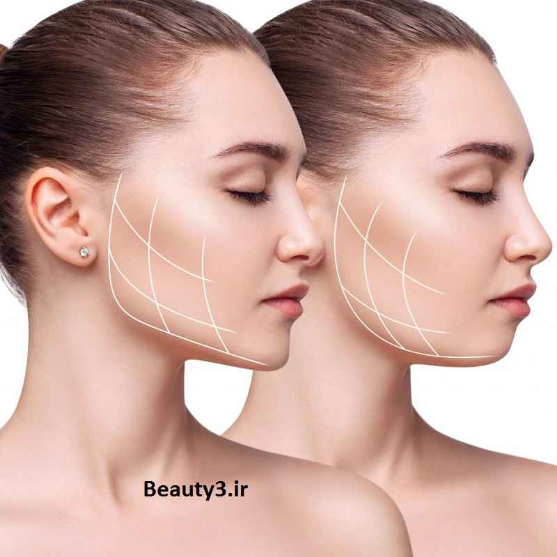 تزریق ژل چانه